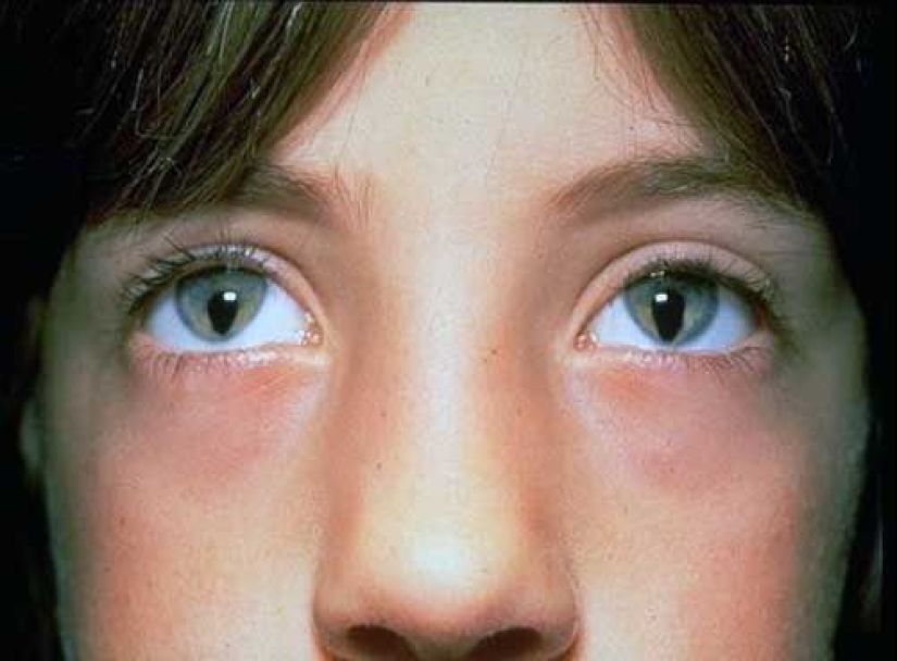 8 anomalías que demostrar lo impredecible de la genética