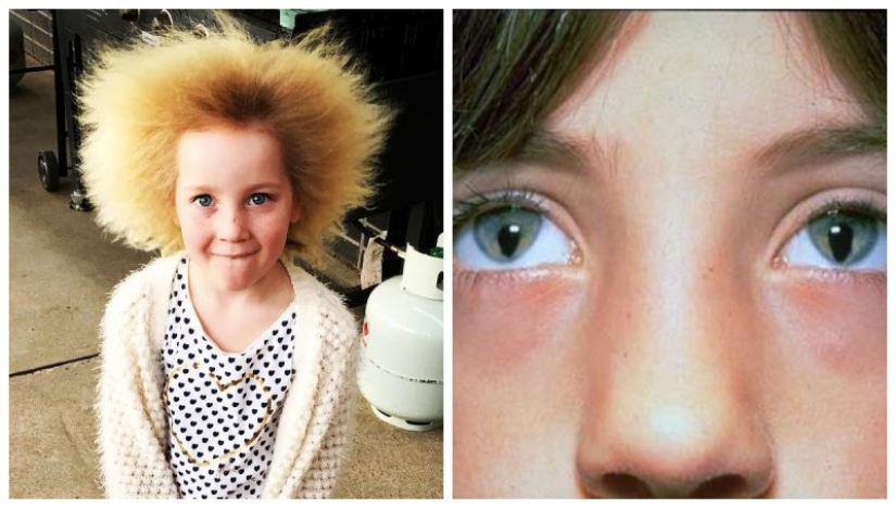 8 anomalies that demonstrate how unpredictable genetics