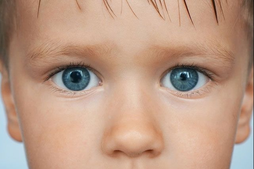 8 anomalies that demonstrate how unpredictable genetics