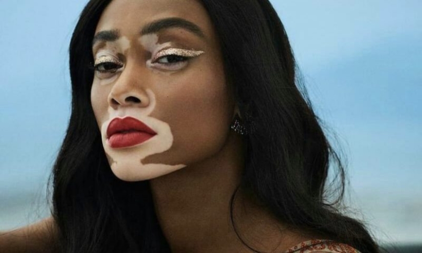 8 anomalies that demonstrate how unpredictable genetics