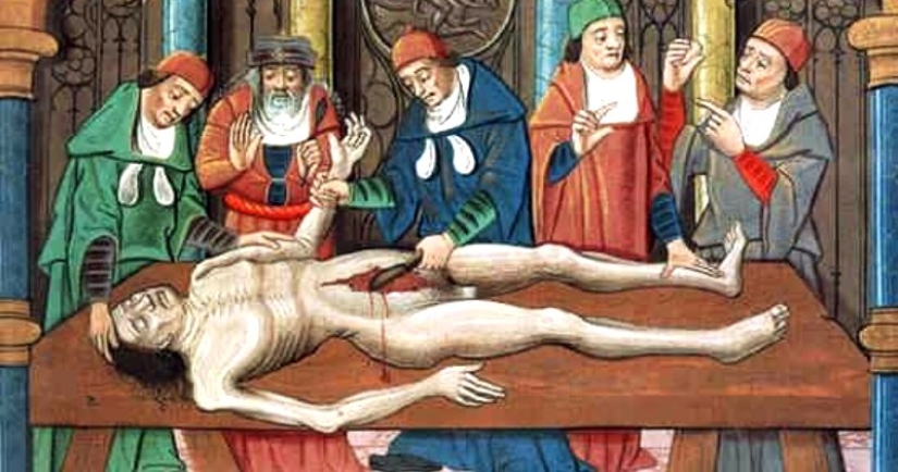 8 enfermedades terribles y simplemente inexplicables del pasado