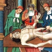 8 terrible and simply inexplicable diseases of the past