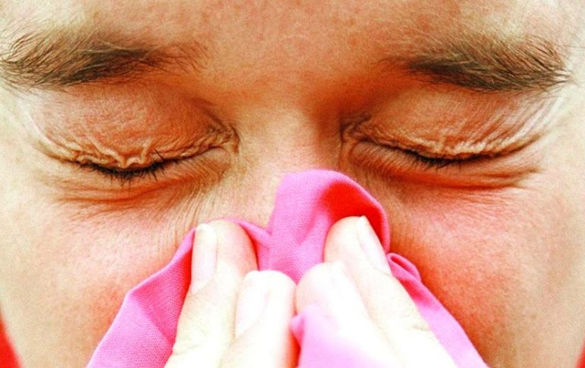 9 Formas comprobadas de Deshacerse de las bolsas debajo de los Ojos 9 Formas comprobadas de Deshacerse de las bolsas debajo de los Ojos