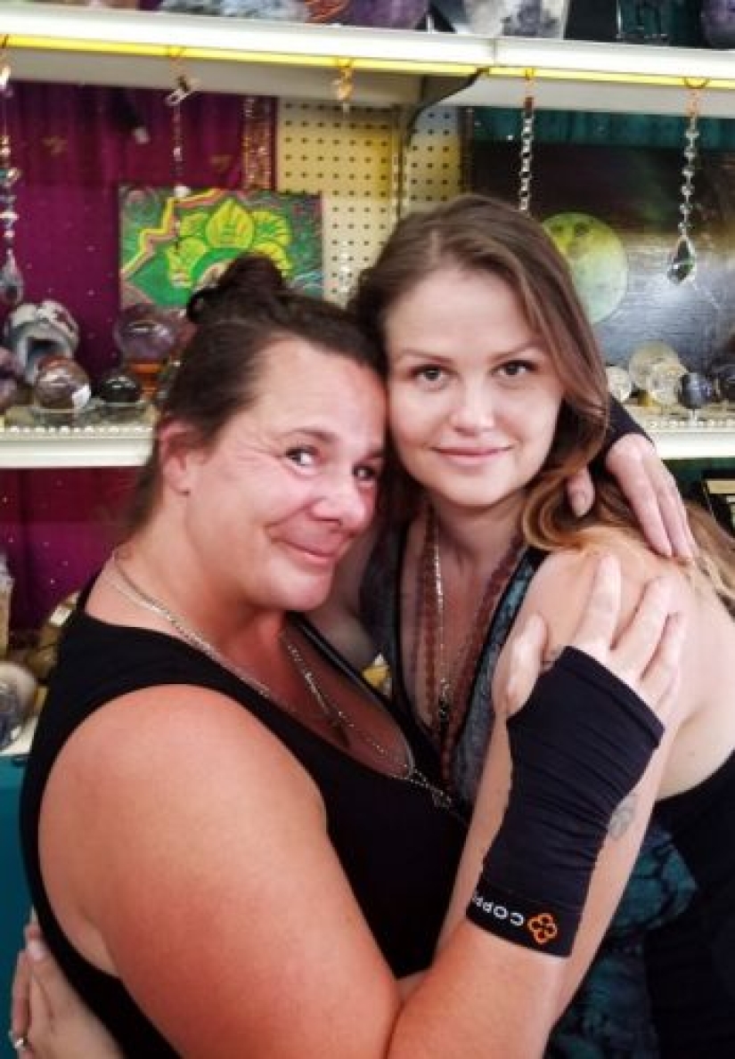 A hair scrunchie almost made a woman disabled