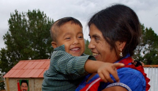 A Mexican woman became a sensation by making herself a caesarean section with a kitchen knife