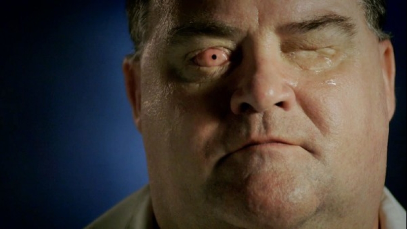 A real miracle: 10 of the most amazing cases of healing in medicine A real miracle: 10 of the most amazing cases of healing in medicine