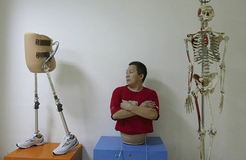 A real miracle: 10 of the most amazing cases of healing in medicine A real miracle: 10 of the most amazing cases of healing in medicine