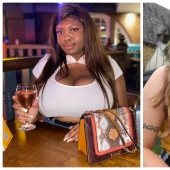 A stone on the heart: how women with large breasts suffer in everyday life