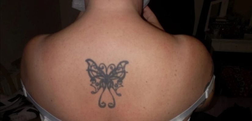 A stone on the heart: how women with large breasts suffer in everyday life