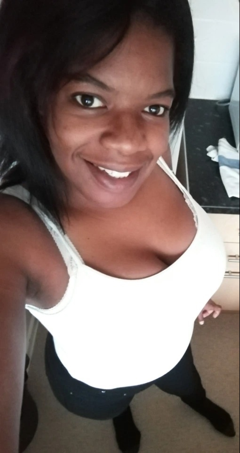 A stone on the heart: how women with large breasts suffer in everyday life