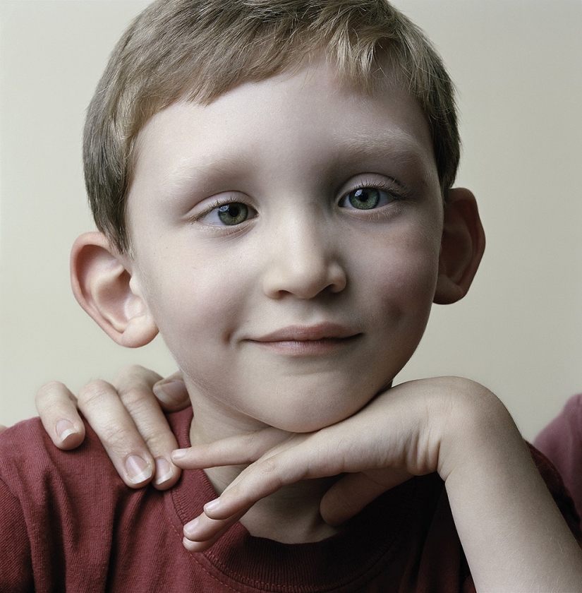 About Face: photo portraits of people suffering from paralysis