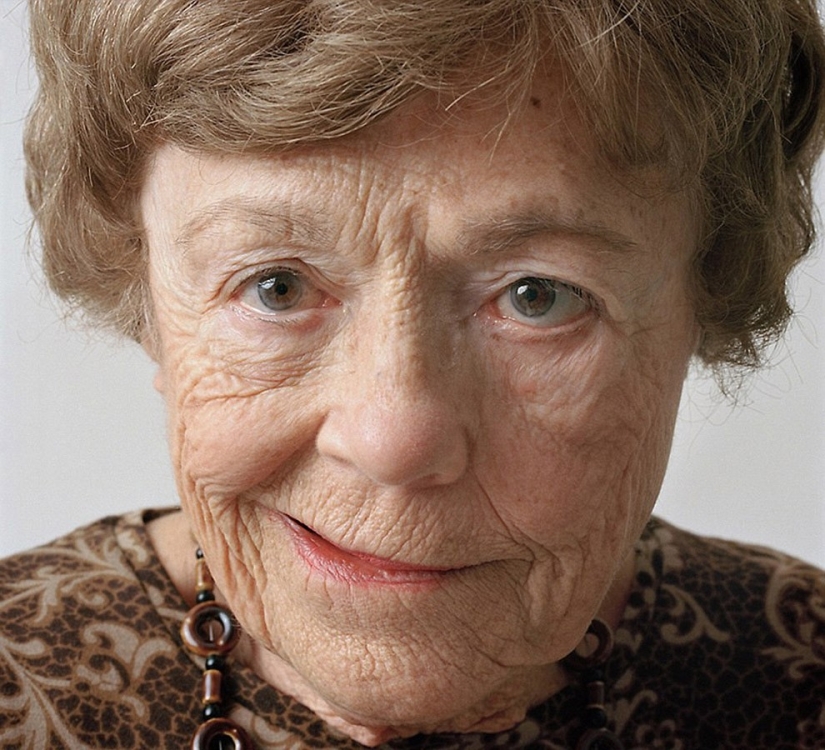 About Face: photo portraits of people suffering from paralysis