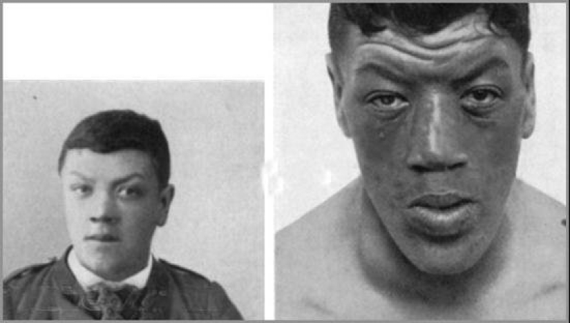 Adam Rainer: the story of an unfortunate guy who managed to be a dwarf and a giant