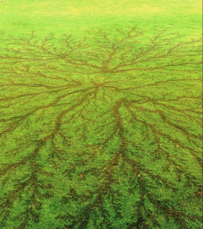 After discharge: what happens to a man who was struck by lightning