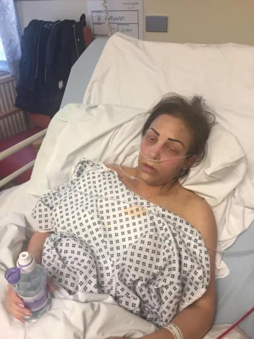 Airbag: stories of women whose breast implants saved their lives Airbag: stories of women whose breast implants saved their lives