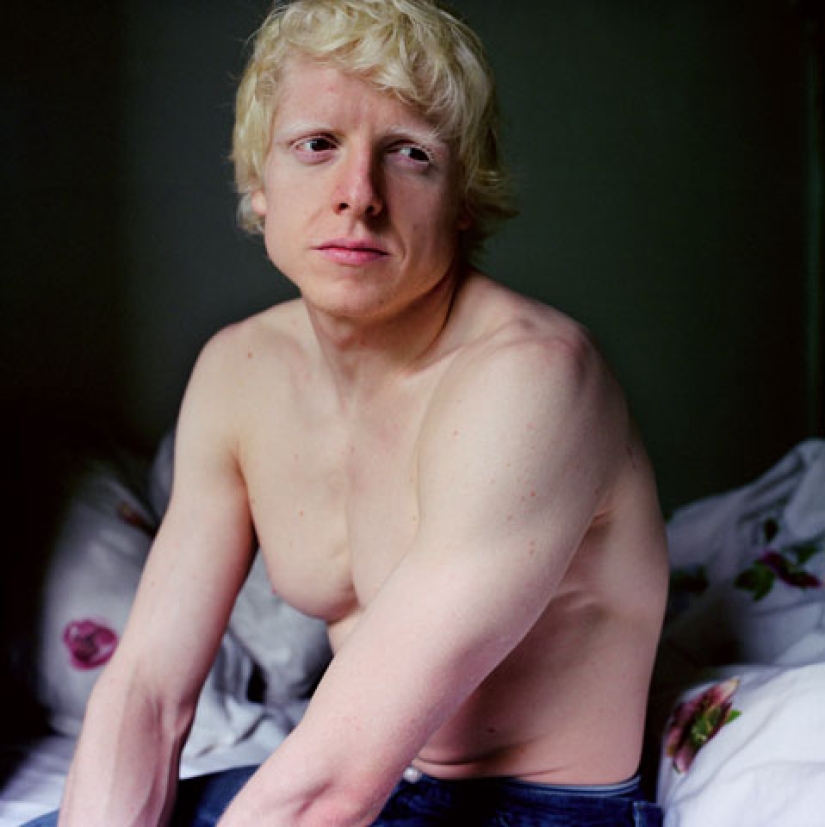 Albinos de Paola de Grene