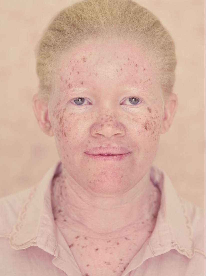 Albinos en la lente de Gustavo Lacerde Albinos en la lente de Gustavo Lacerde