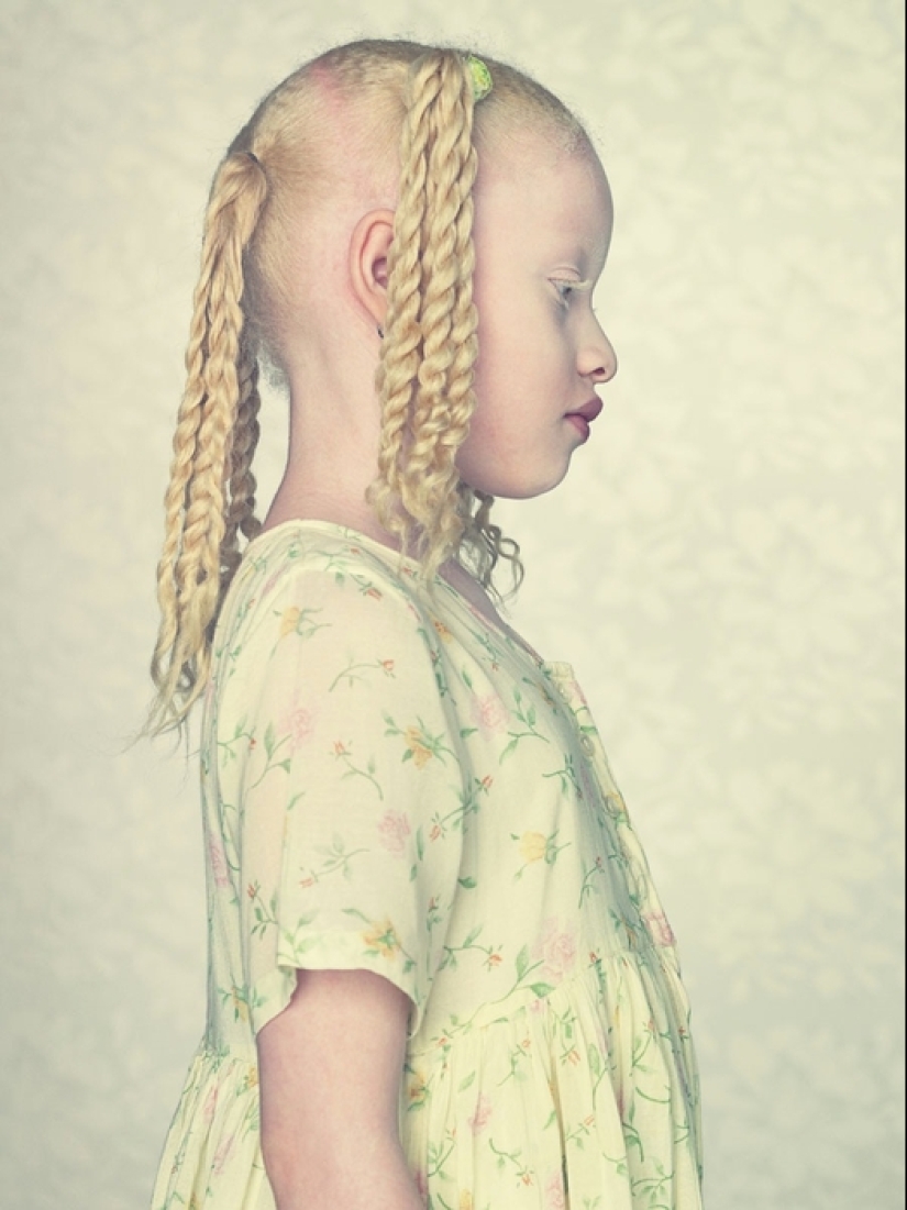 Albinos in the lens of Gustavo Lacerde