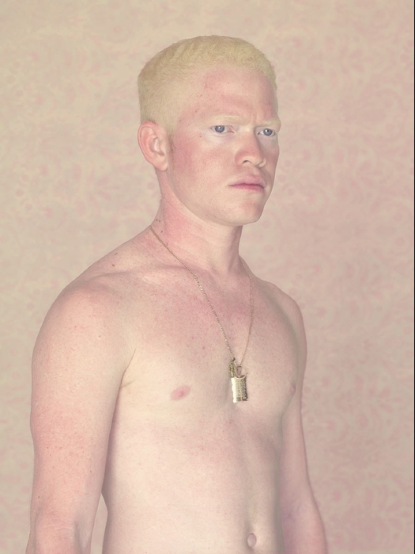 Albinos in the lens of Gustavo Lacerde
