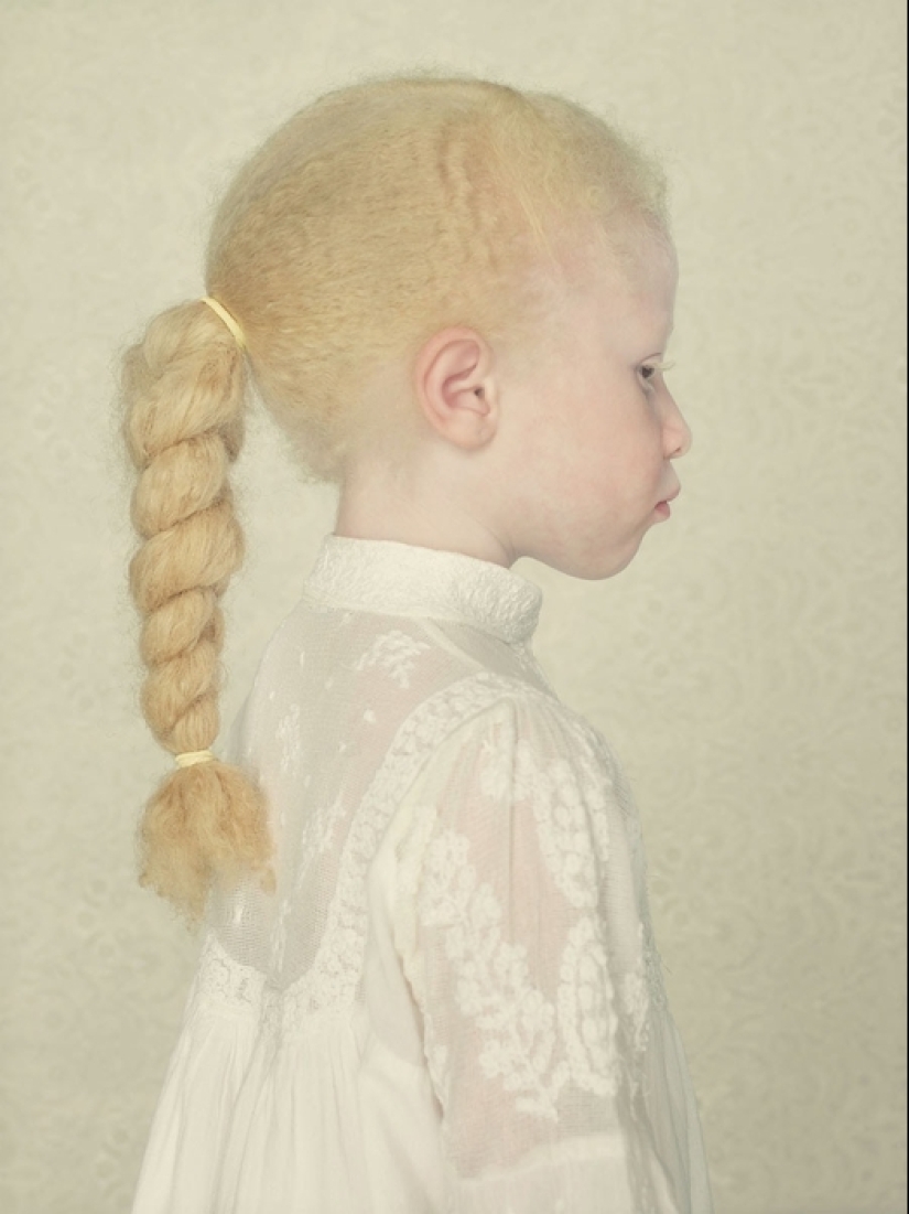 Albinos in the lens of Gustavo Lacerde