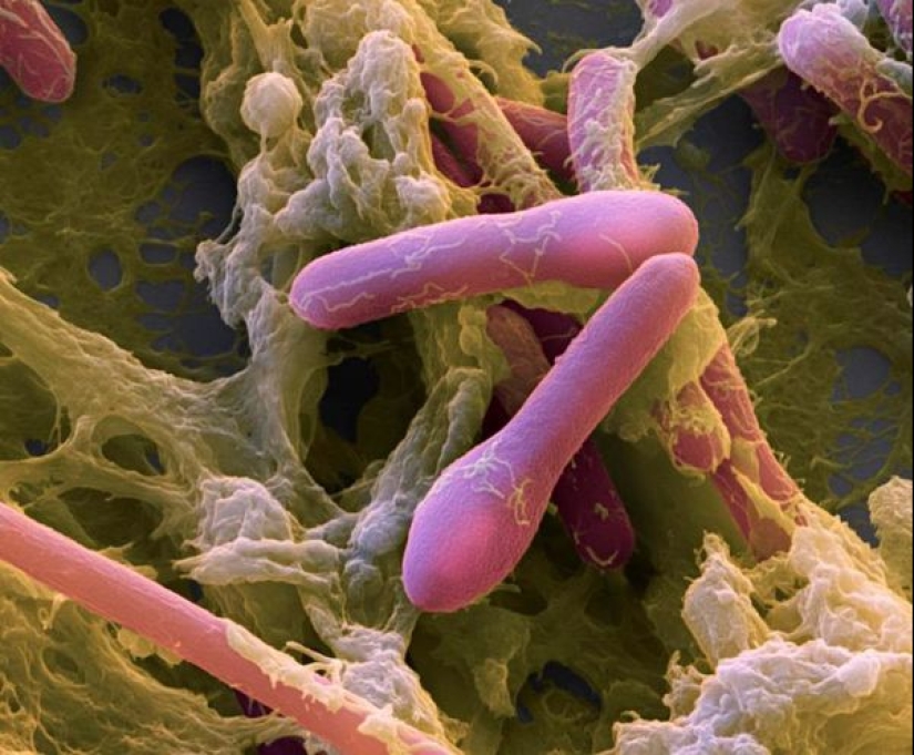 Almost a detective story, or How humanity became acquainted with botulism Almost a detective story, or How humanity became acquainted with botulism