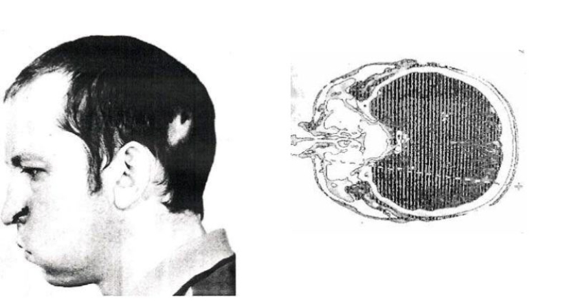 Anatoly Bugorsky is a man who stuck his head into a working particle accelerator and survived Anatoly Bugorsky is a man who stuck his head into a working particle accelerator and survived