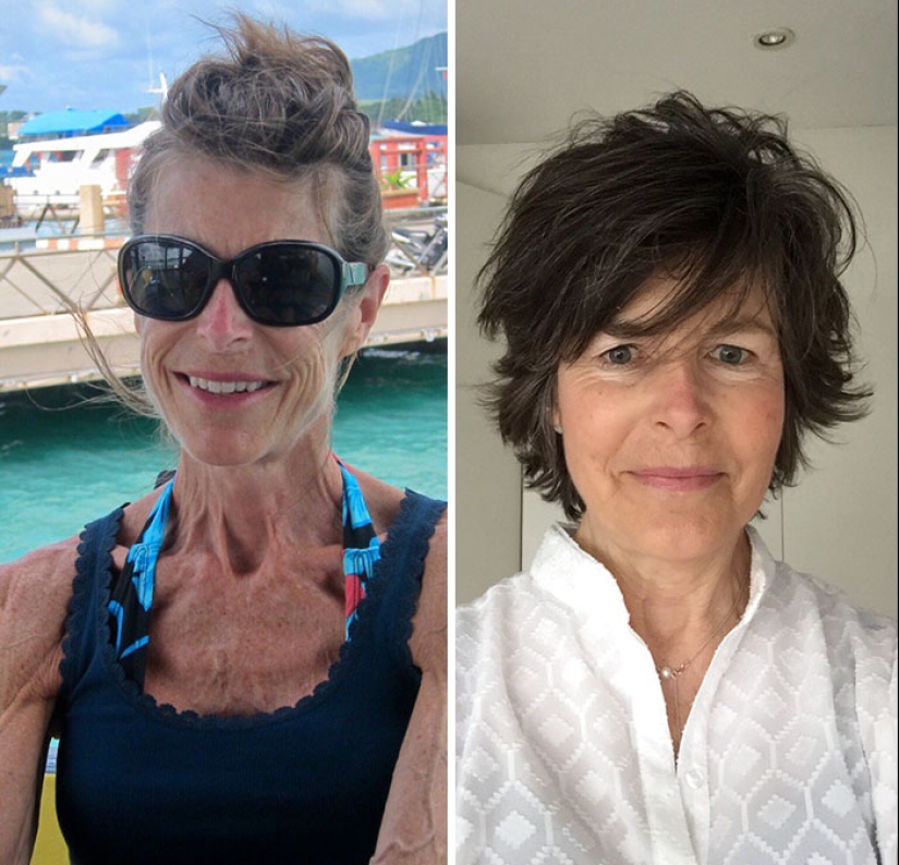 Antes y después: 20 ejemplos de personas que lograron superar la anorexia Antes y después: 20 ejemplos de personas que lograron superar la anorexia