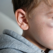 Badyaga: te salva de moretones, y ni siquiera sabes que no es una planta