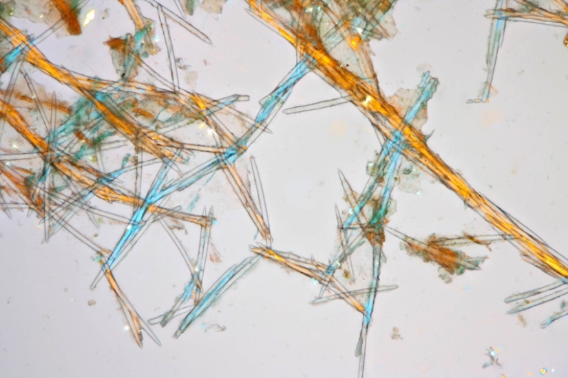 Badyaga: te salva de moretones, y ni siquiera sabes que no es una planta