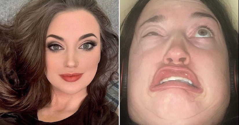 Bellezas y monstruos: 22 chicas mostraron lo diferentes que pueden ser Bellezas y monstruos: 22 chicas mostraron lo diferentes que pueden ser