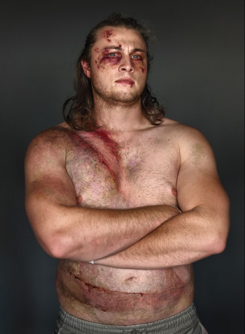 Belt survivors: 10 magnificent photos that will convince you to wear Belt survivors: 10 magnificent photos that will convince you to wear