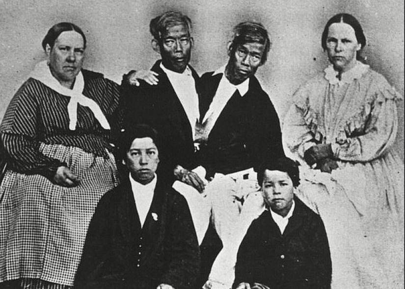 Chang and Eng Bunker: The Story of the Brothers Who Created the Concept of 'Siamese Twins' Chang and Eng Bunker: The Story of the Brothers Who Created the Concept of 'Siamese Twins'