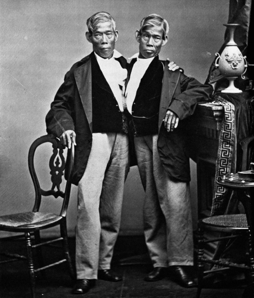 Chang and Eng Bunker: The Story of the Brothers Who Created the Concept of 'Siamese Twins' Chang and Eng Bunker: The Story of the Brothers Who Created the Concept of 'Siamese Twins'