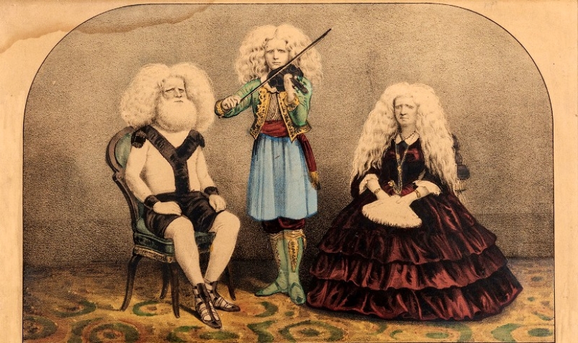 Circus albinos of the 19th century: people with shocking appearances and fictitious destinies