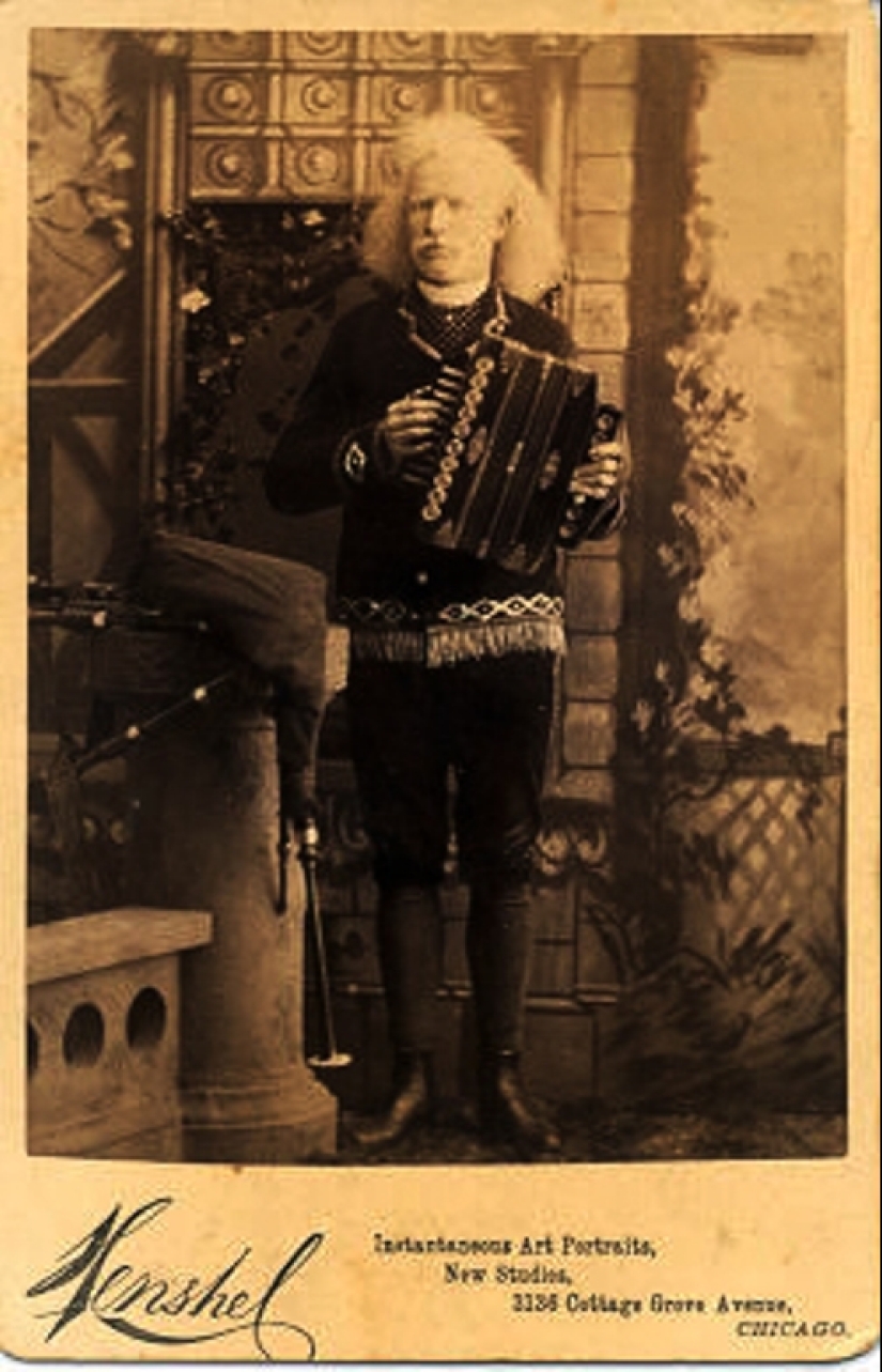 Circus albinos of the 19th century: people with shocking appearances and fictitious destinies