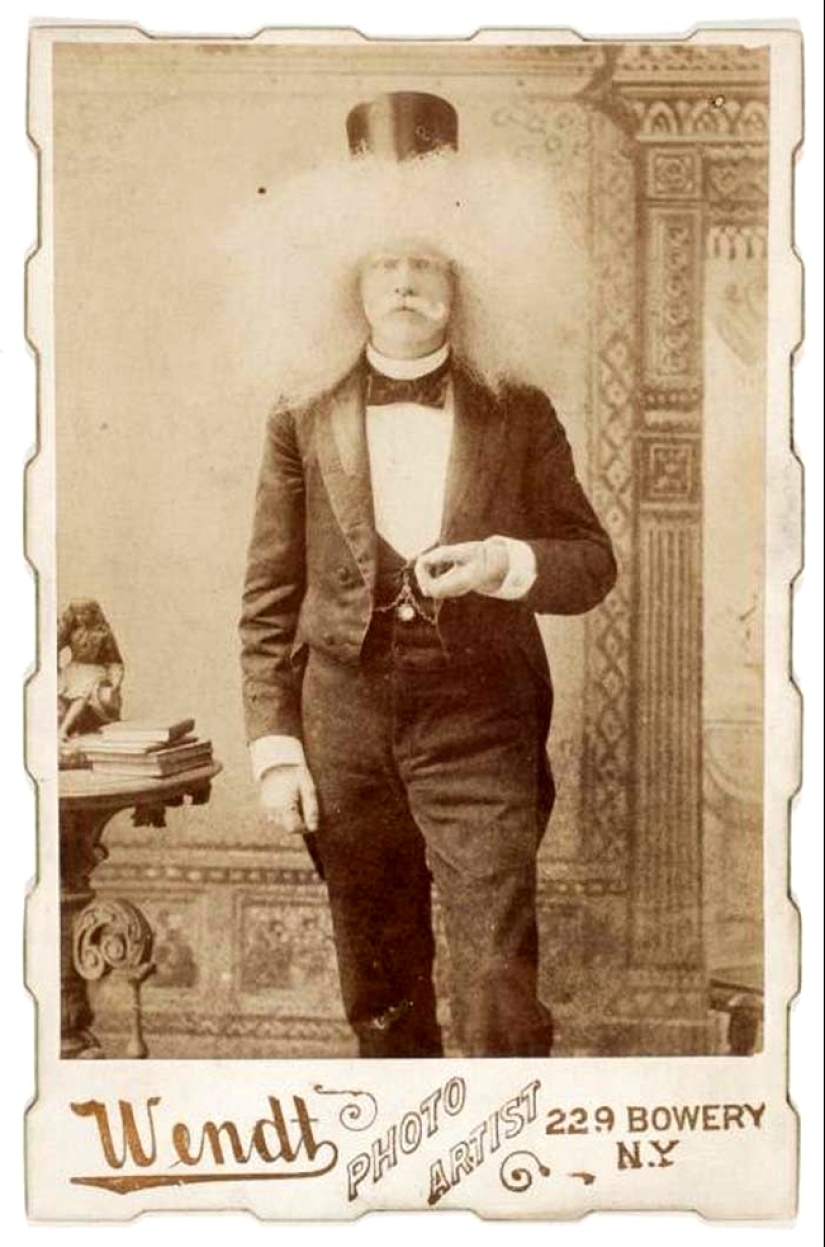 Circus albinos of the 19th century: people with shocking appearances and fictitious destinies