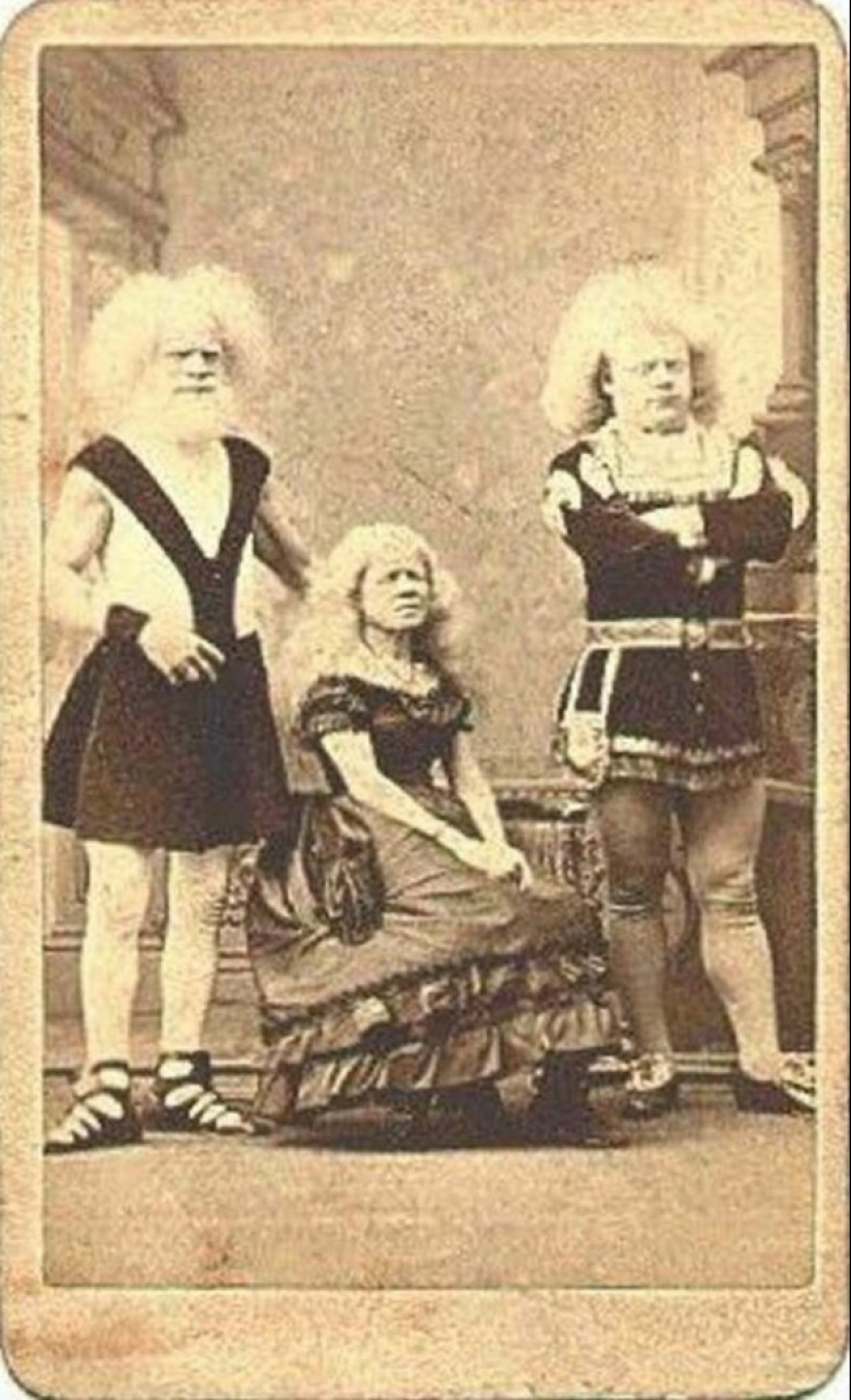 Circus albinos of the 19th century: people with shocking appearances and fictitious destinies