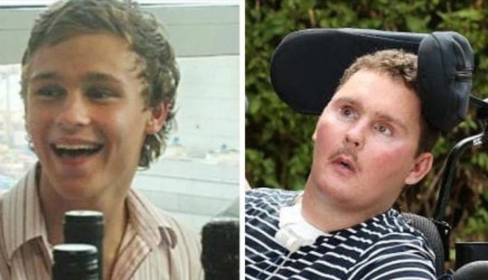 Comió un lingote cayó en coma y murió 8 años más tarde: ¿qué llevó a un inocente amistoso debate