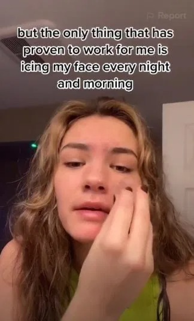 Consejos dañinos: Los trucos de vida populares de TikTok pueden arruinar tu piel Consejos dañinos: Los trucos de vida populares de TikTok pueden arruinar tu piel