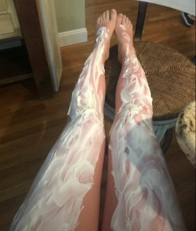 Consejos dañinos: trucos de la vida popular en la lucha contra las quemaduras solares que no deben repetirse