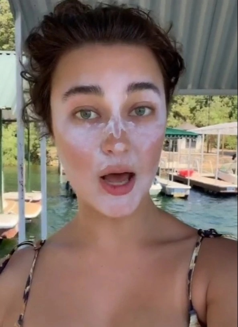 Consejos dañinos: trucos de la vida popular en la lucha contra las quemaduras solares que no deben repetirse