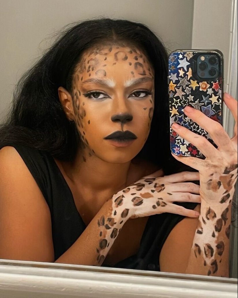 Dancer-Turned-Artist Amara Aleman Turns Her Vitiligo Into Vibrant Body Art Dancer-Turned-Artist Amara Aleman Turns Her Vitiligo Into Vibrant Body Art