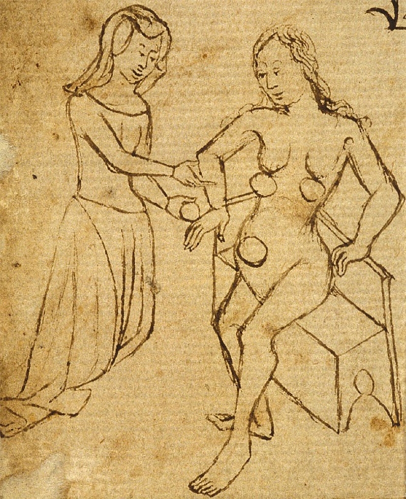 De Cola a testículos de castor: 9 de los métodos anticonceptivos más extraños del pasado