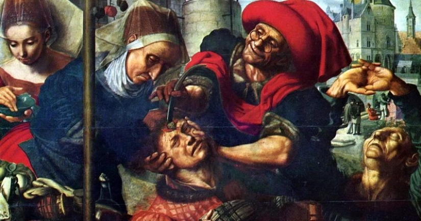 De Hipócrates a Pirogov: la cirugía de campo militar en diferentes épocas De Hipócrates a Pirogov: la cirugía de campo militar en diferentes épocas