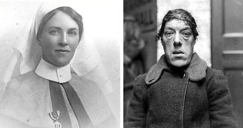 De la belleza de la bestia: una historia de Mary Ann Webster — el más feo de las mujeres en el mundo