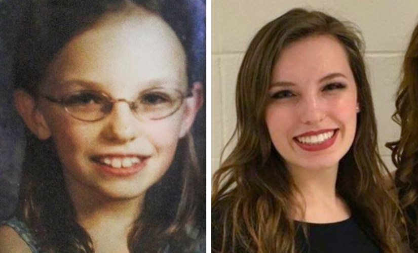 De un patito feo a un cisne hermoso: estos 18 adolescentes demostraron que cualquiera puede convertirse en un hombre guapo