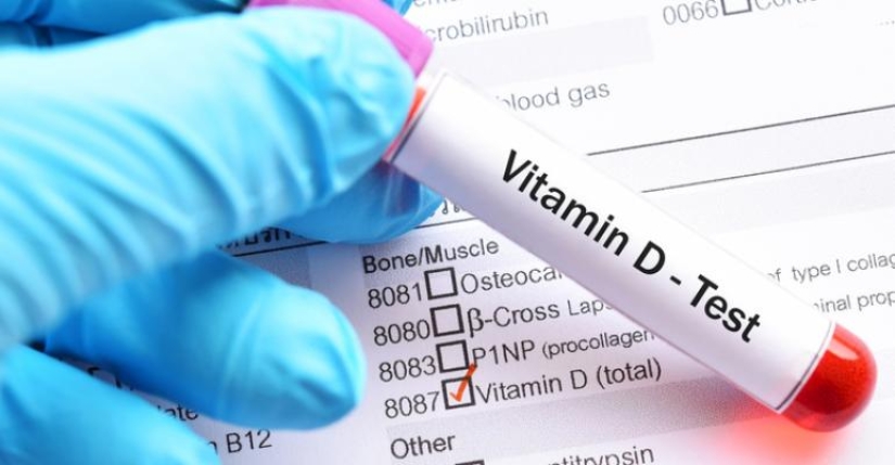 Dispelling 7 myths about vitamin D, which stubbornly continue to believe Dispelling 7 myths about vitamin D, which stubbornly continue to believe