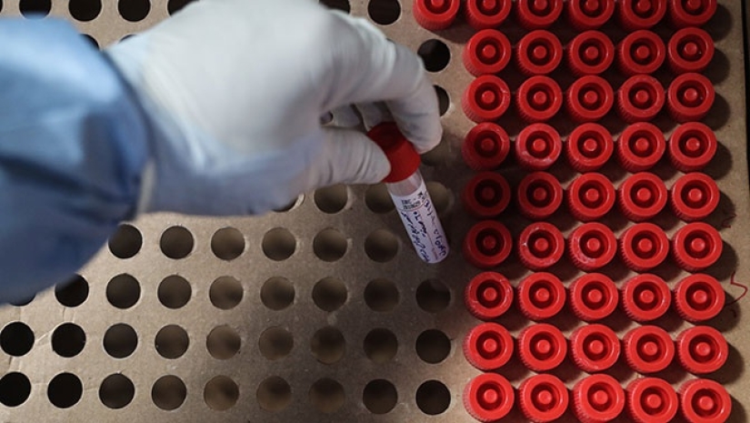 Donde el ruso tuvo II grupo sanguíneo, el cual es llamado "el campesino"