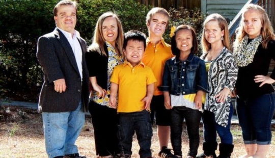 Dwarfs and midgets: how different are these little people Dwarfs and midgets: how different are these little people