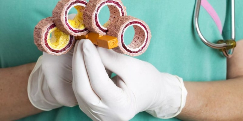 El aceite de palma al descubierto: informe de la Organización Mundial de la Salud